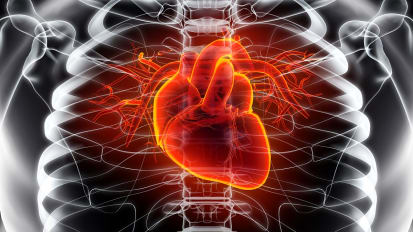 Percutaneous Mitral Valve Replacement (MitraClip) Procedure Patient CareMap