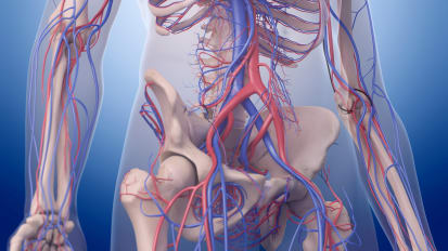 Case Presentations: Transcaval Access for TAVR