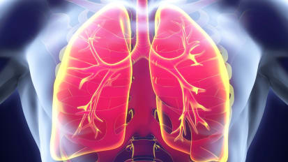 Lung Transplant Patient CareMap