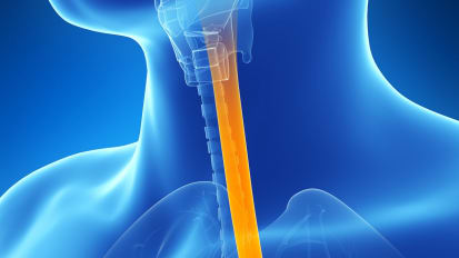 Esophagectomy Clinical Care Pathway