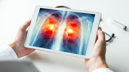 Saved by the Scan: An Interview with Lung Cancer Specialist Doraid Jarrar, MD