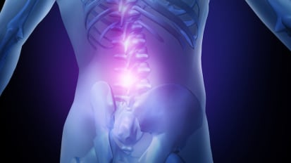 Lumbar Fusion: Strategies to Lower Complications and Optimize Corrections