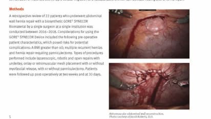 The Role of a Biosynthetic Hybrid Mesh in Abdominal Wall Hernia Repair in High-Risk Patients with Multiple Comorbidities