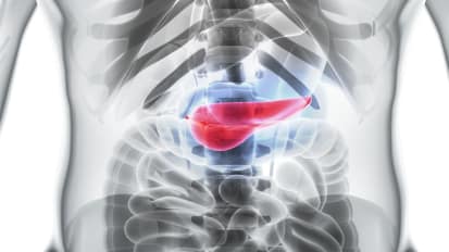 Distal Pancreatectomy with or without Splenectomy Patient CareMap