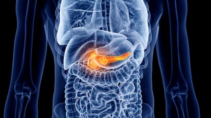 Pancreaticoduodenectomy/Whipple Patient CareMap: Your Hospital Stay