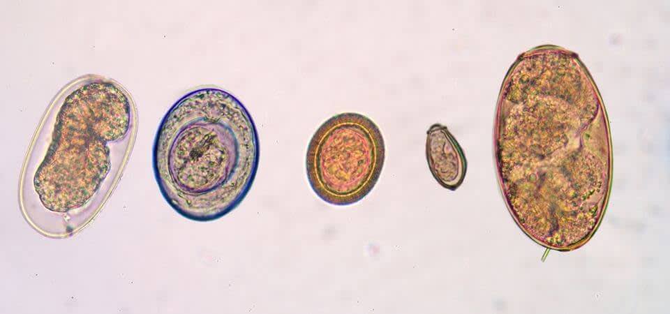 parasites in stool microscope