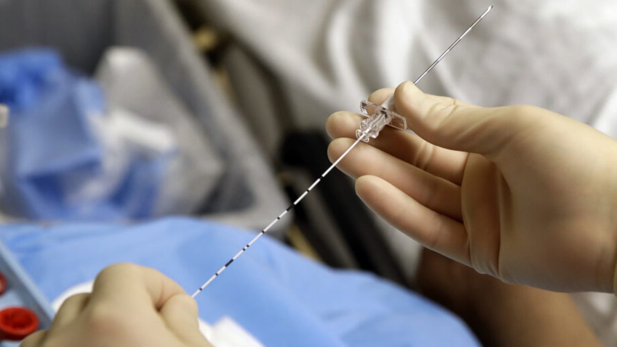 Medicare limits coverage for pain relief procedures Medicare limits coverage for pain relief procedures - pain relief