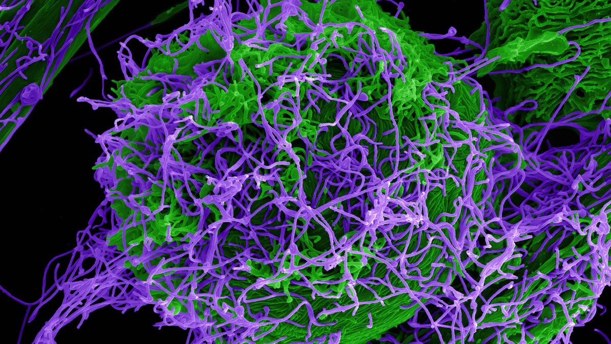 Guinea builds labs to fight Ebola, Marburg, Lassa Guinea builds labs to fight Ebola, Marburg, Lassa - guinea viral hemorrhagic fever