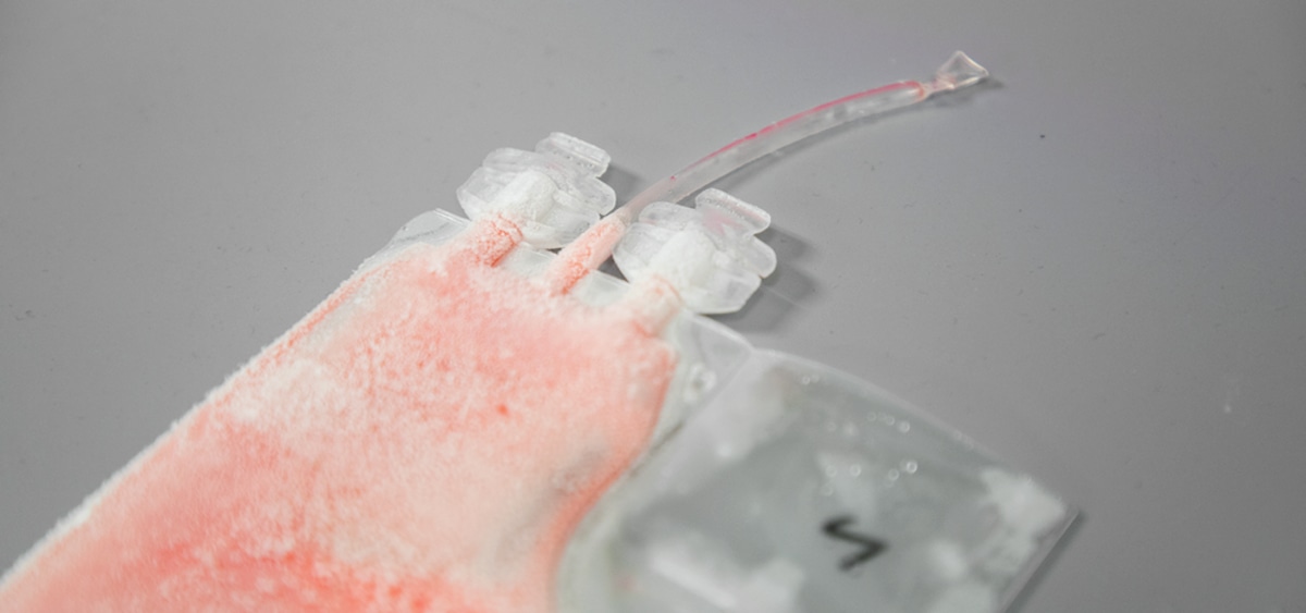 Discovery Life Sciences Streamlines Cell And Gene Therapy Manufacturing With Expanded Human Cellular Starting Materials