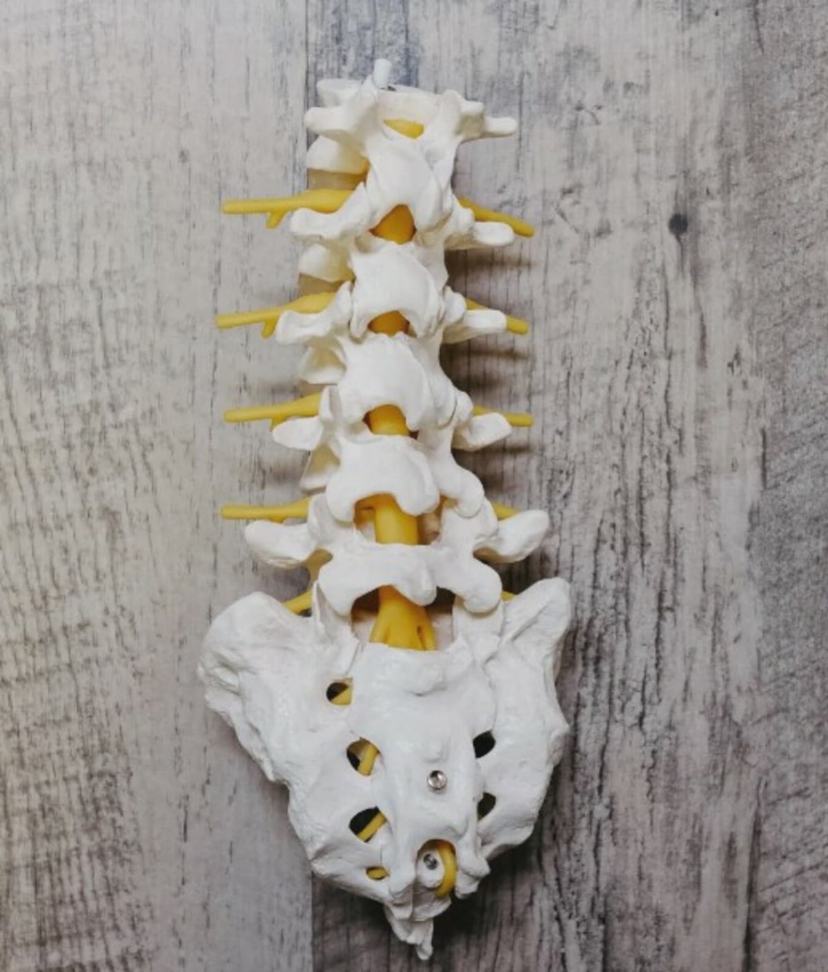 Low Back Pain: Treatment-Based Classification in Athletes