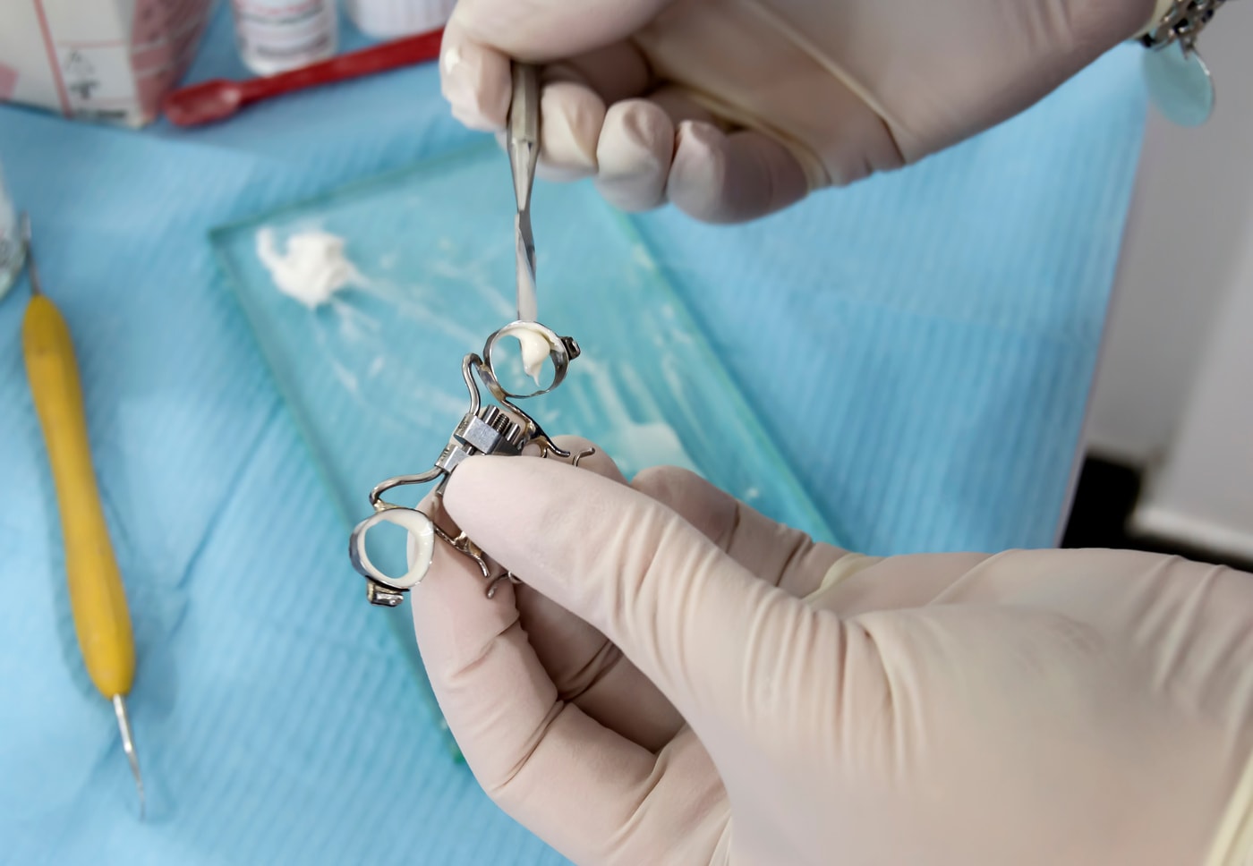 Invisalign