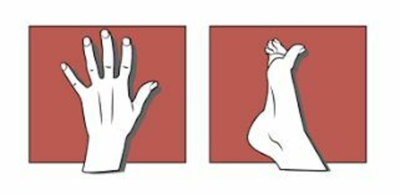 Lateralization Therapy Flashcards
