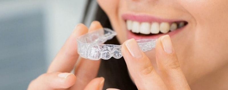  Invisalign