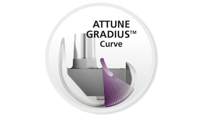 ATTUNE GRADIUS™ Curve