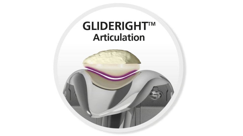 GLIDERIGHT™ Articulation