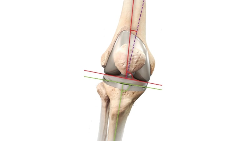 Enhanced Biomechanical Function
