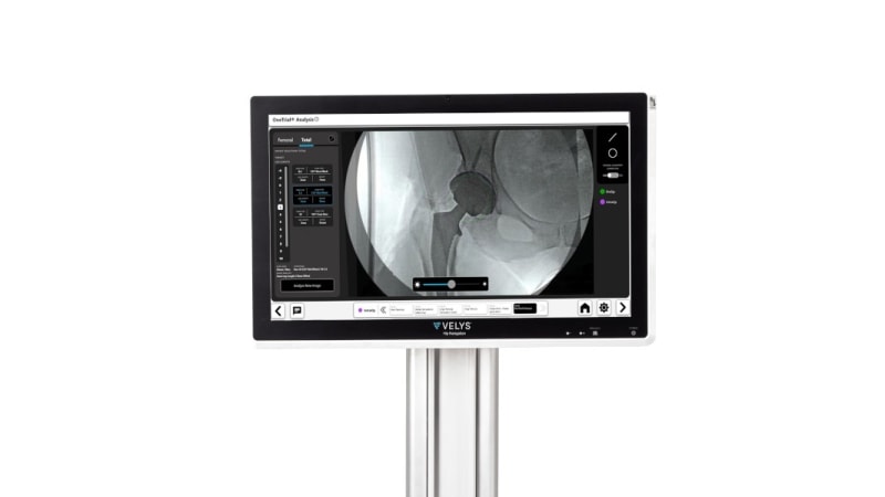 VELYS™ Hip Navigation
