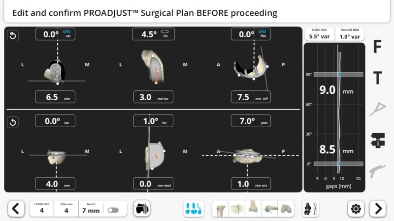 UKA Procedures