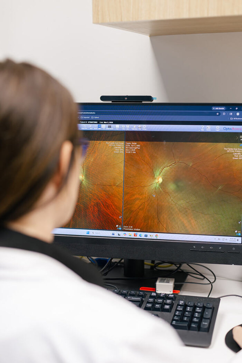 Retina Imaging In Tuscaloosa Al