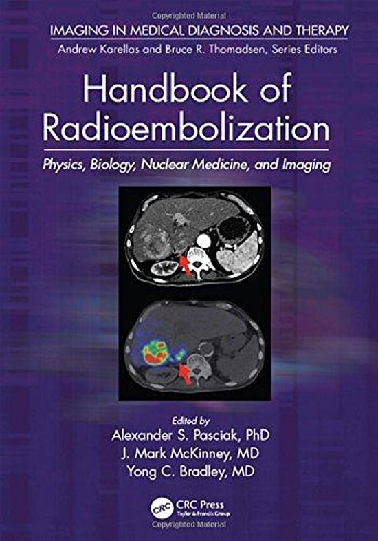 Handbook of Radioembolization img-411