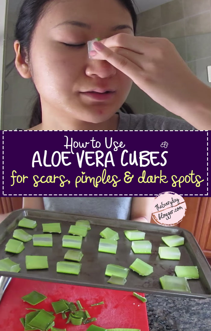 How to use aloe vera for pimples