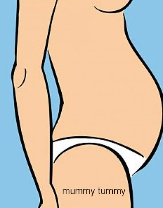 Regaining your muscle tissue after giving birth and doing it right can be a problem. You'll see women this type of tummy on women who had children in the last few years.