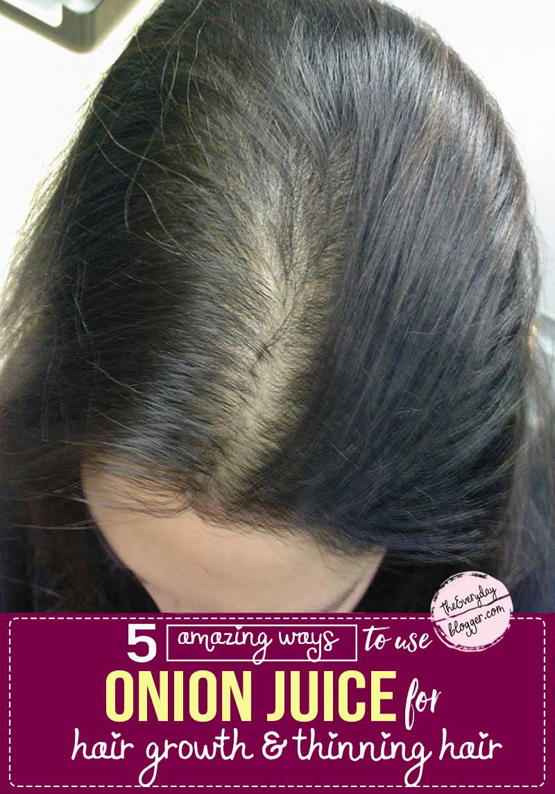 5 Ways to Use Onion Juice for Thinning Hair and Hair Growth The