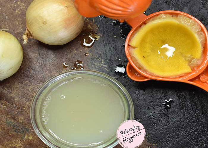 5 Ways to Use Onion Juice for Thinning Hair and Hair Growth The Everyday Blogger