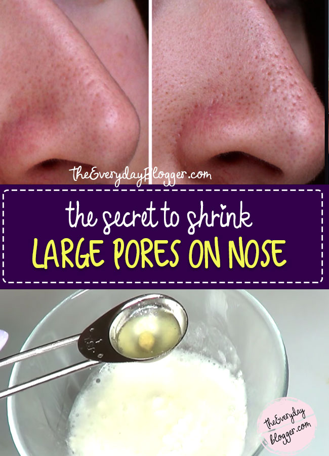 How To Shrink Large Pores On Nose - The Everyday Blogger