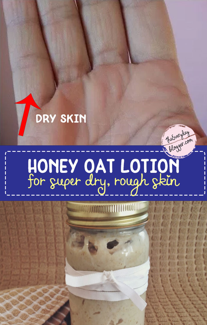 Honey Oat Lotion For Super Dry, Rough Skin The Everyday Blogger