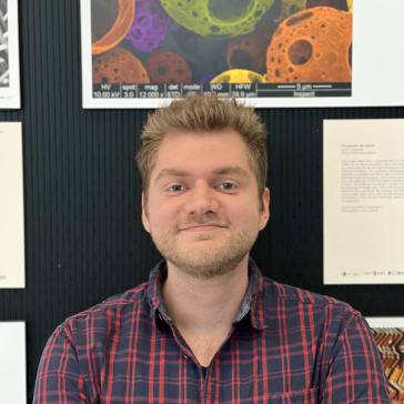 Loïc Steiner, postdoktor vid Linköpings universitet, forskar om hur osteosarkom sprider sig till lungorna.