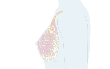 Statistik om cancer | Cancerfonden