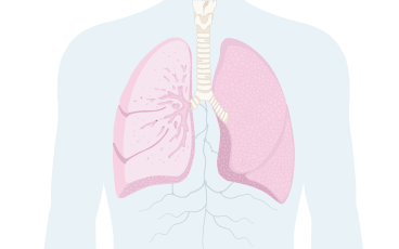 Statistik om cancer | Cancerfonden