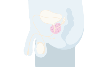 Illustration prostatan