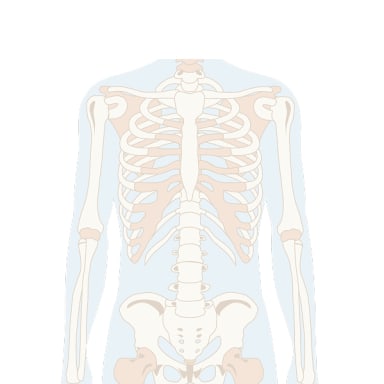 Illustration sarkom i genomskärning - sarkom
