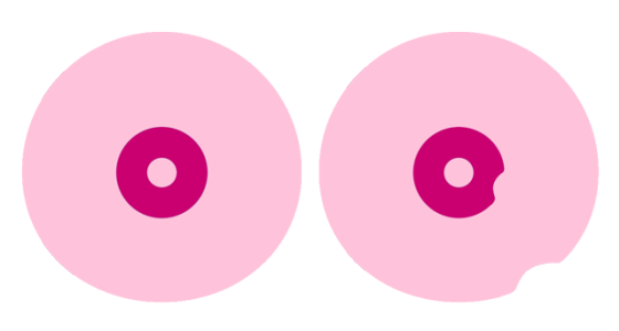 hur känns cancer i bröstet hur känns cancer i bröstet