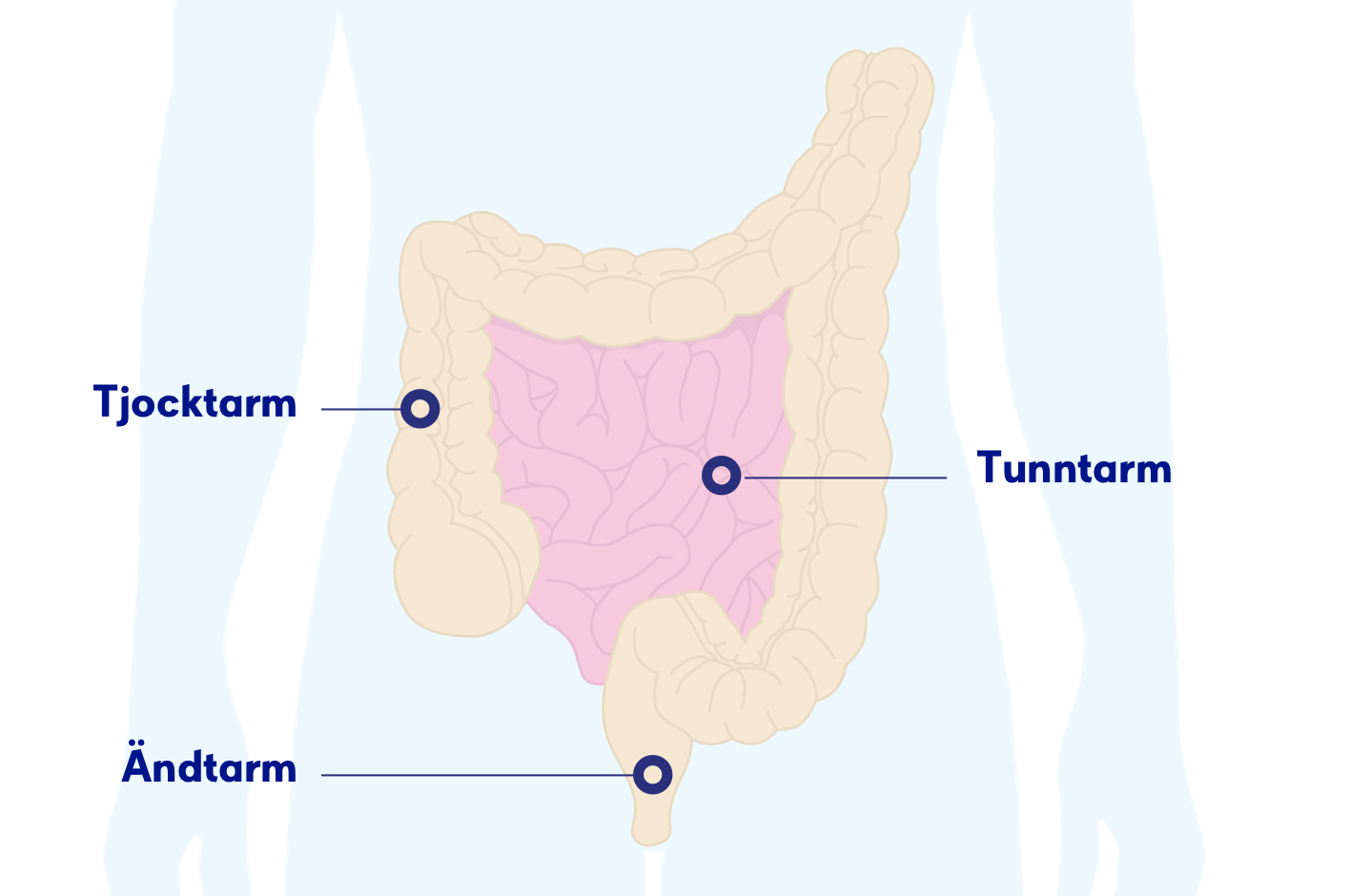 Tunntarmscancer Symtom, orsaker och behandling Cancerfonden