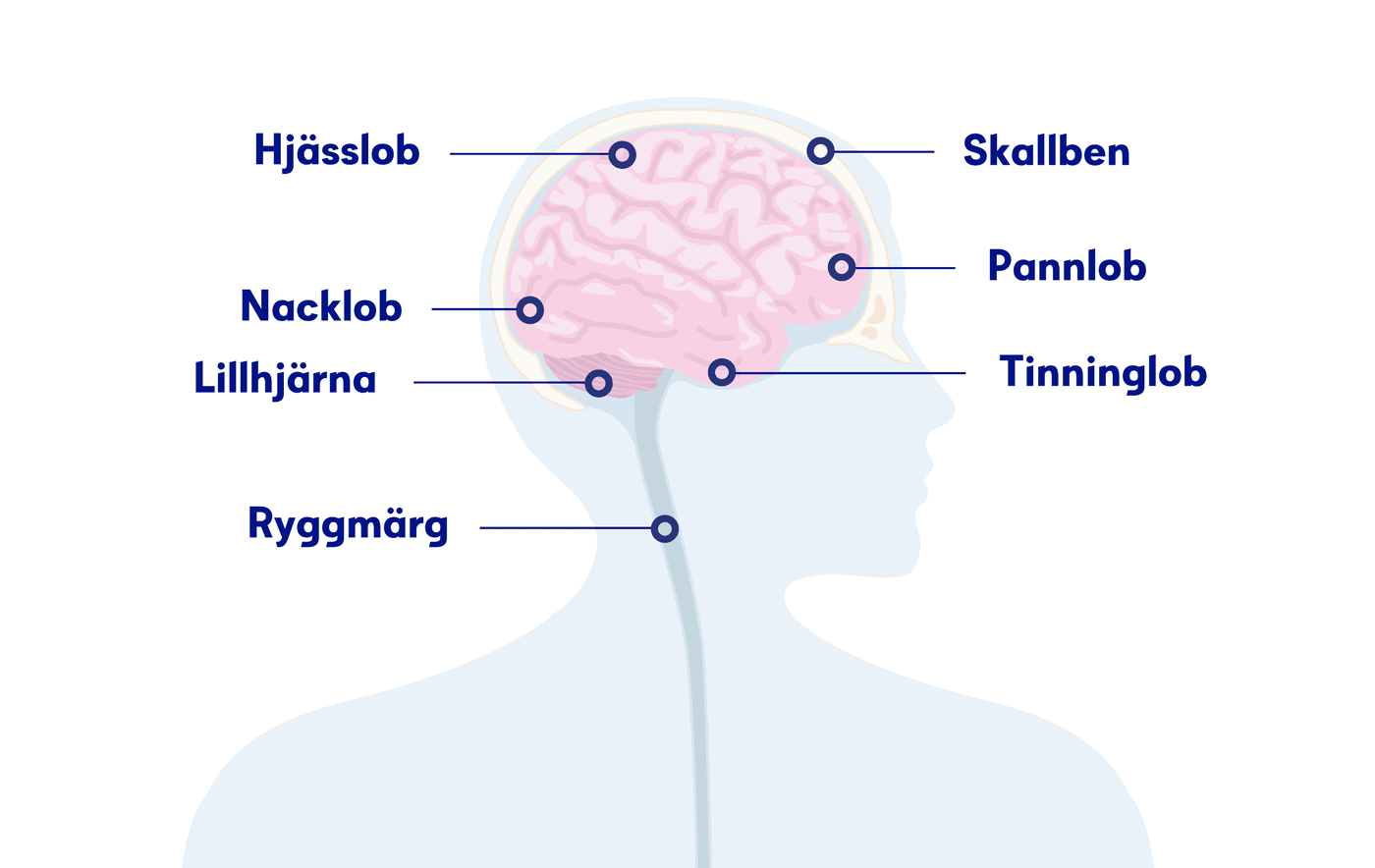 Illustration hjärnan, hjärntumör