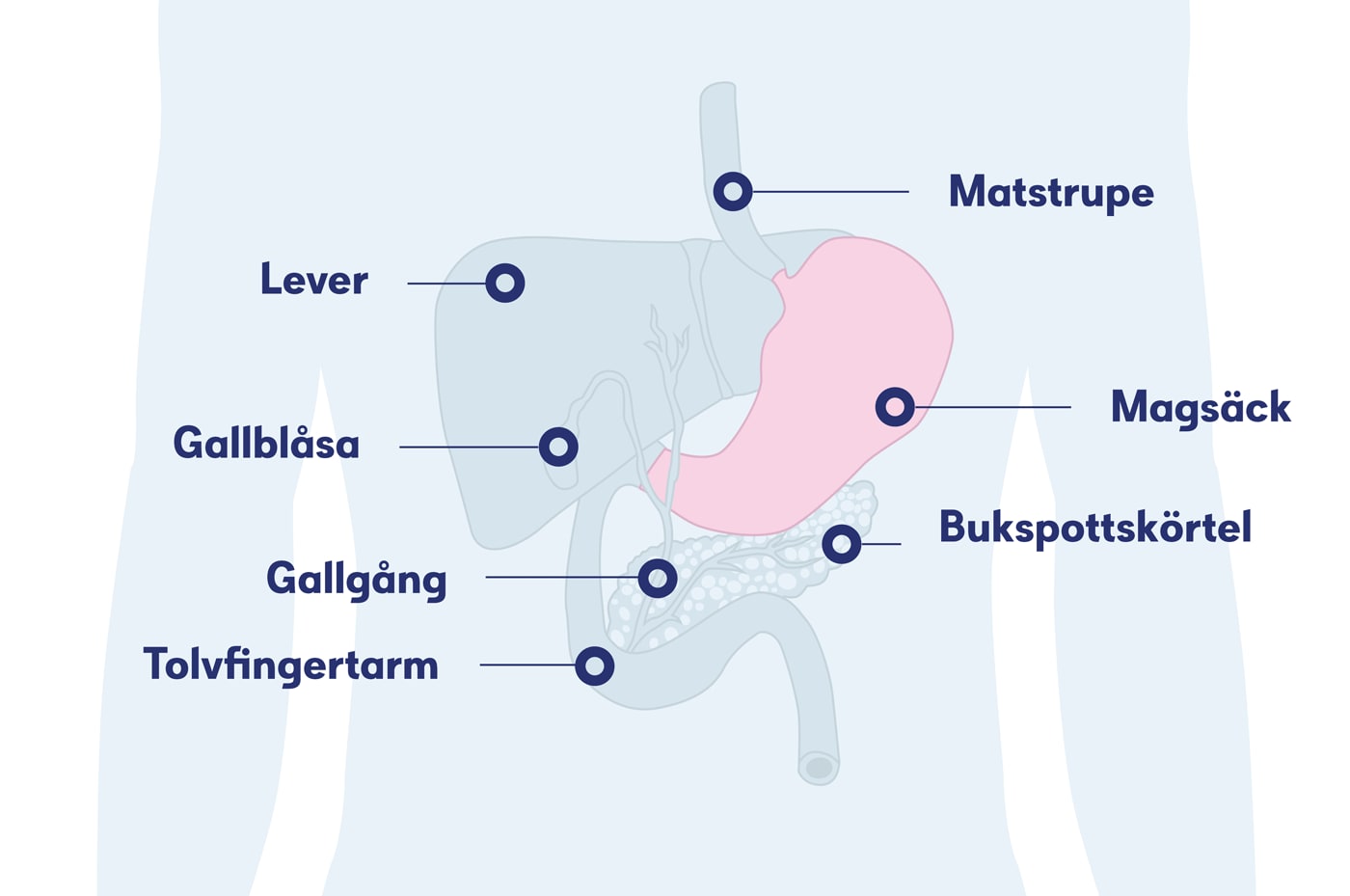 Illustration magsäcken, magsäckscancer