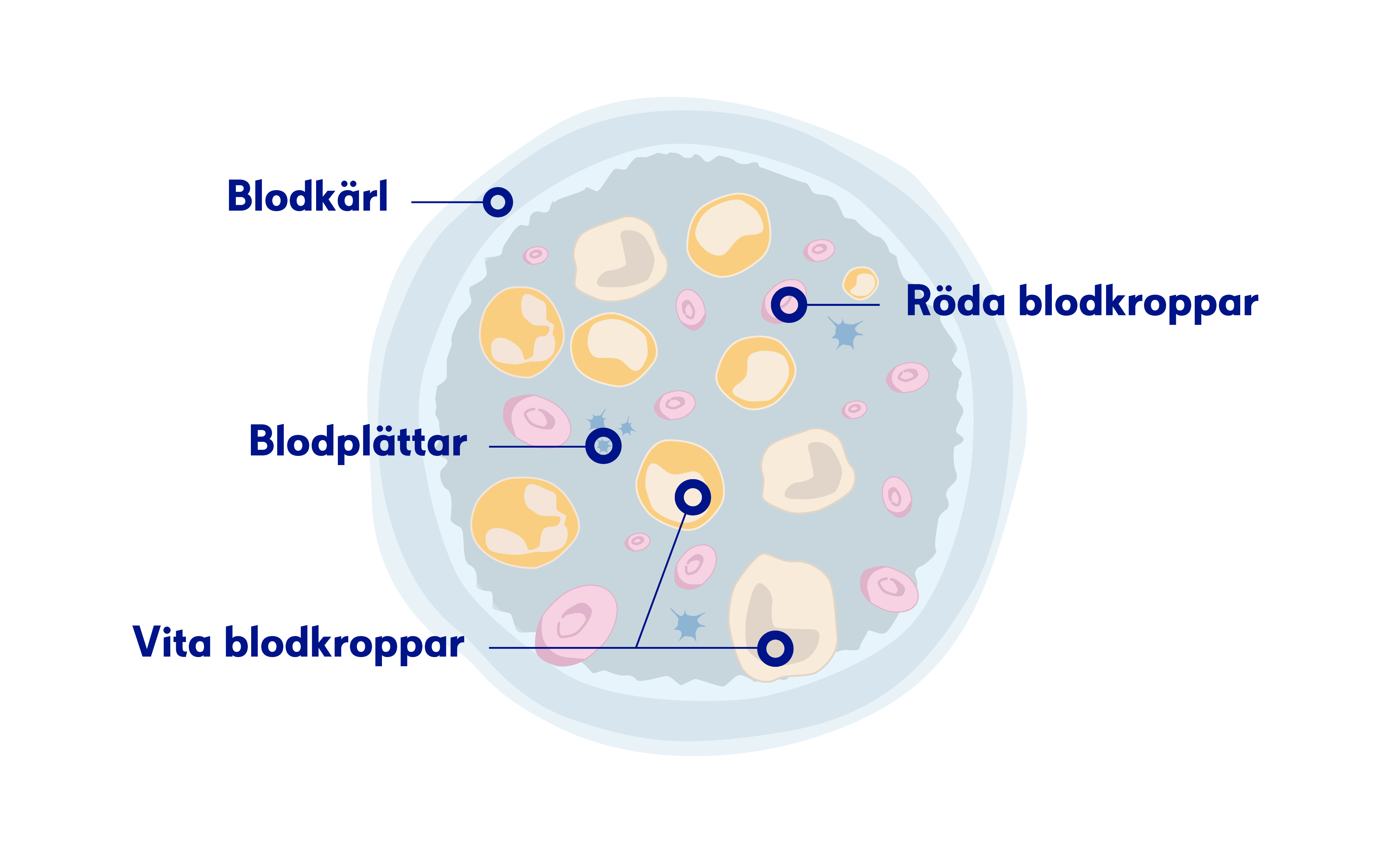 Leucemia mieloide cronica – sintomi, cause e trattamento