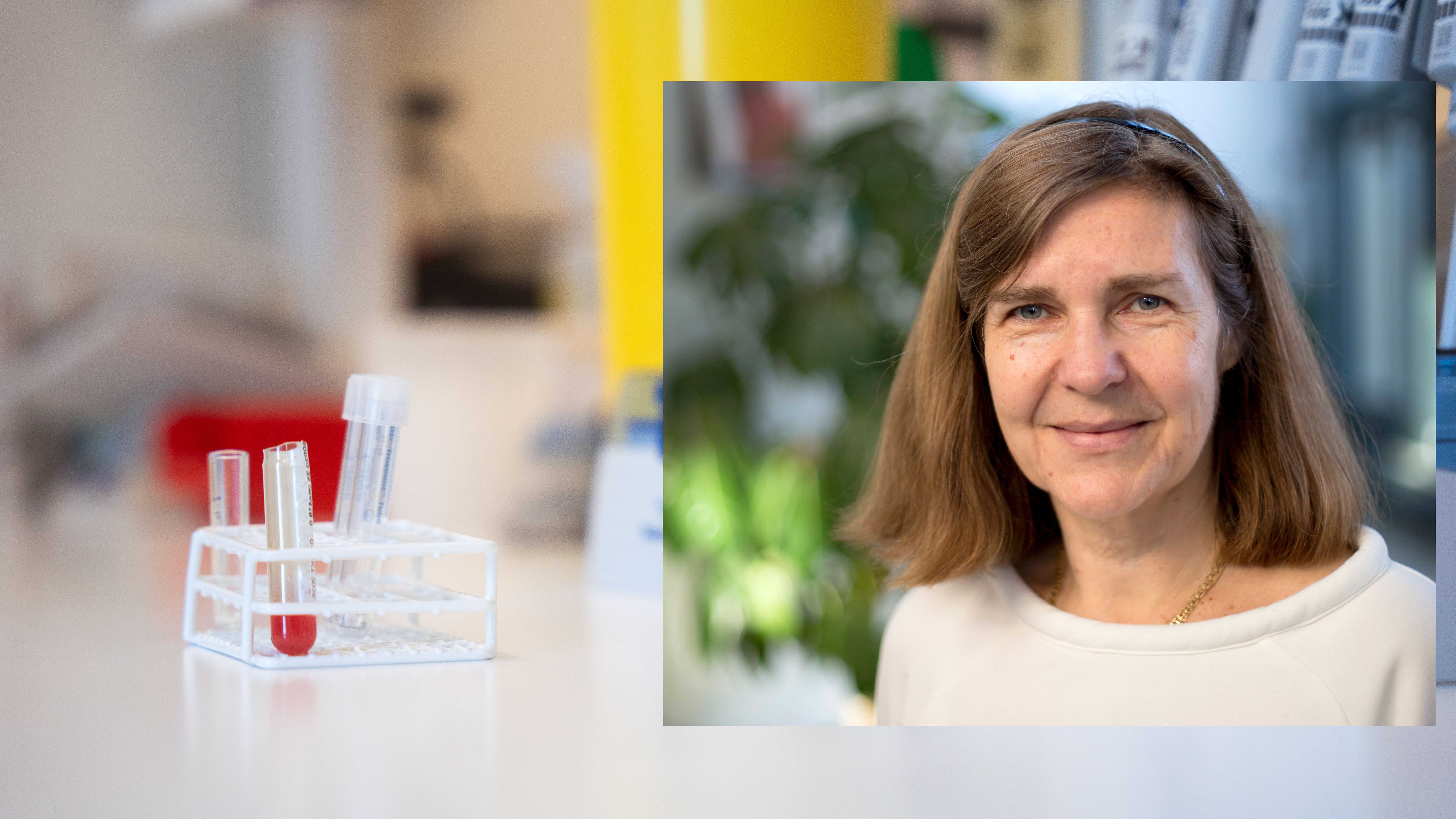 Montage av bilder från blodprov på laboratorium och närbild kvinna.