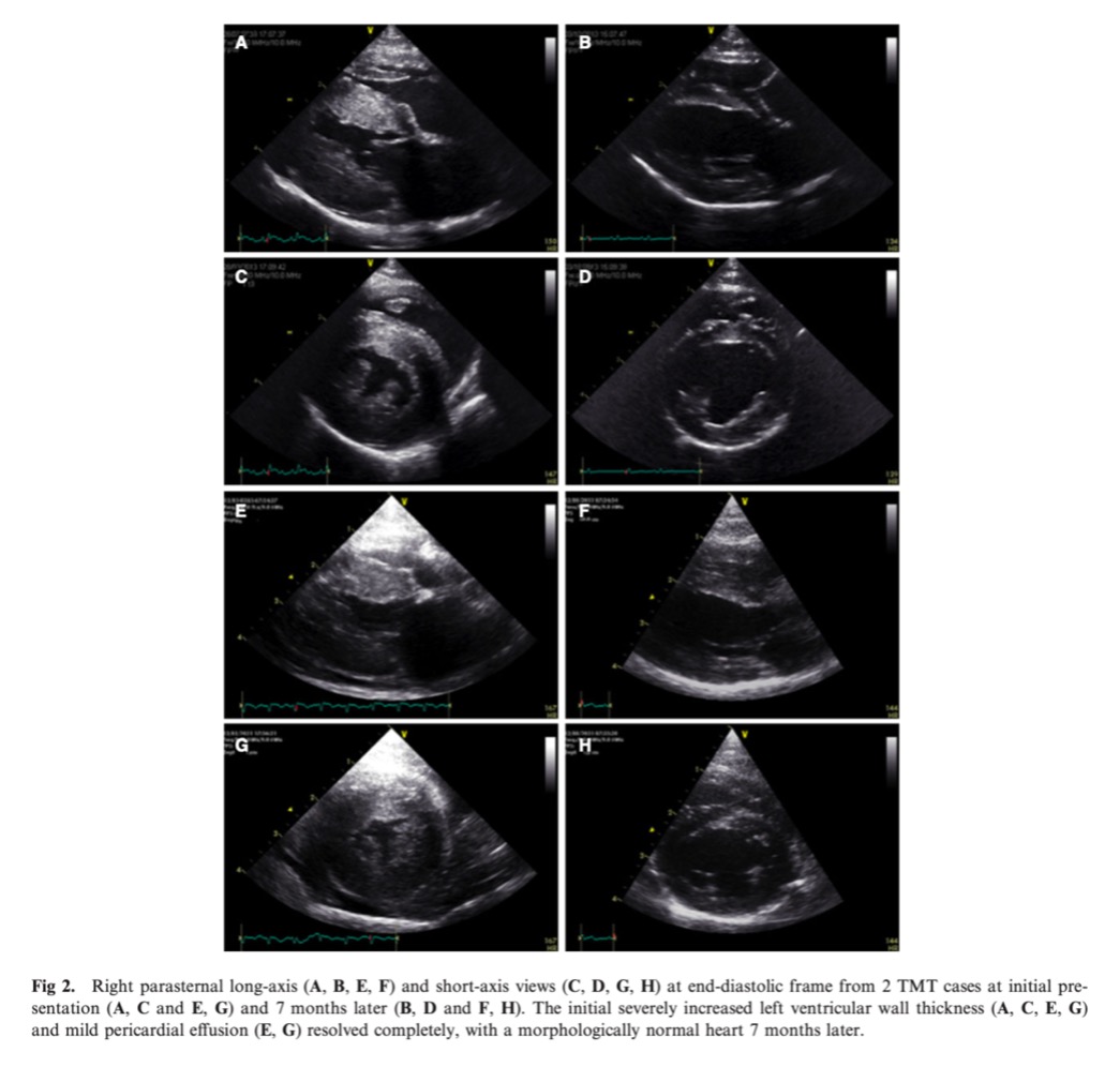 Eight comparative images of cat heart scans showing congestive heart failure