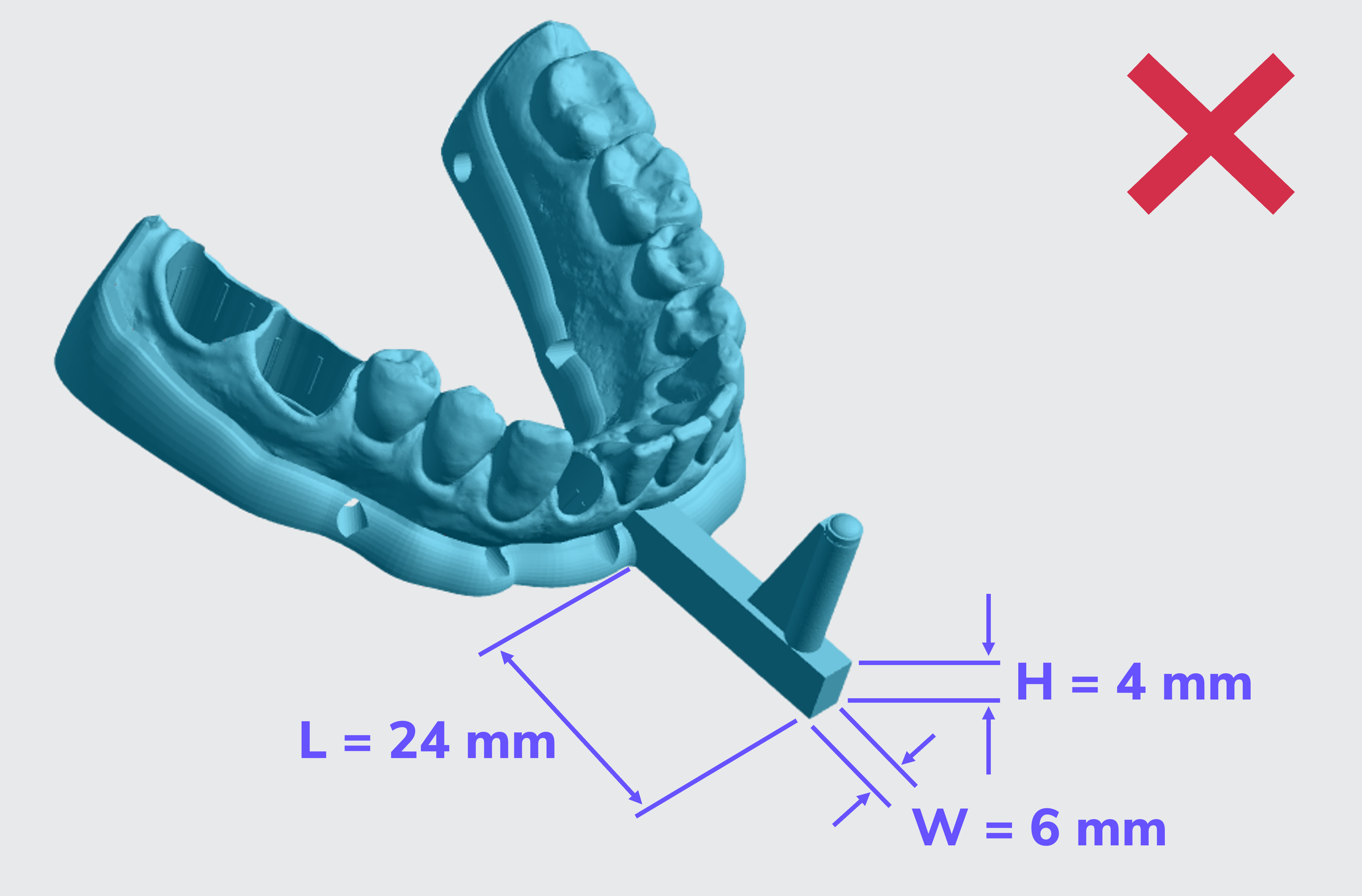 Bad example of articulator base dimensions