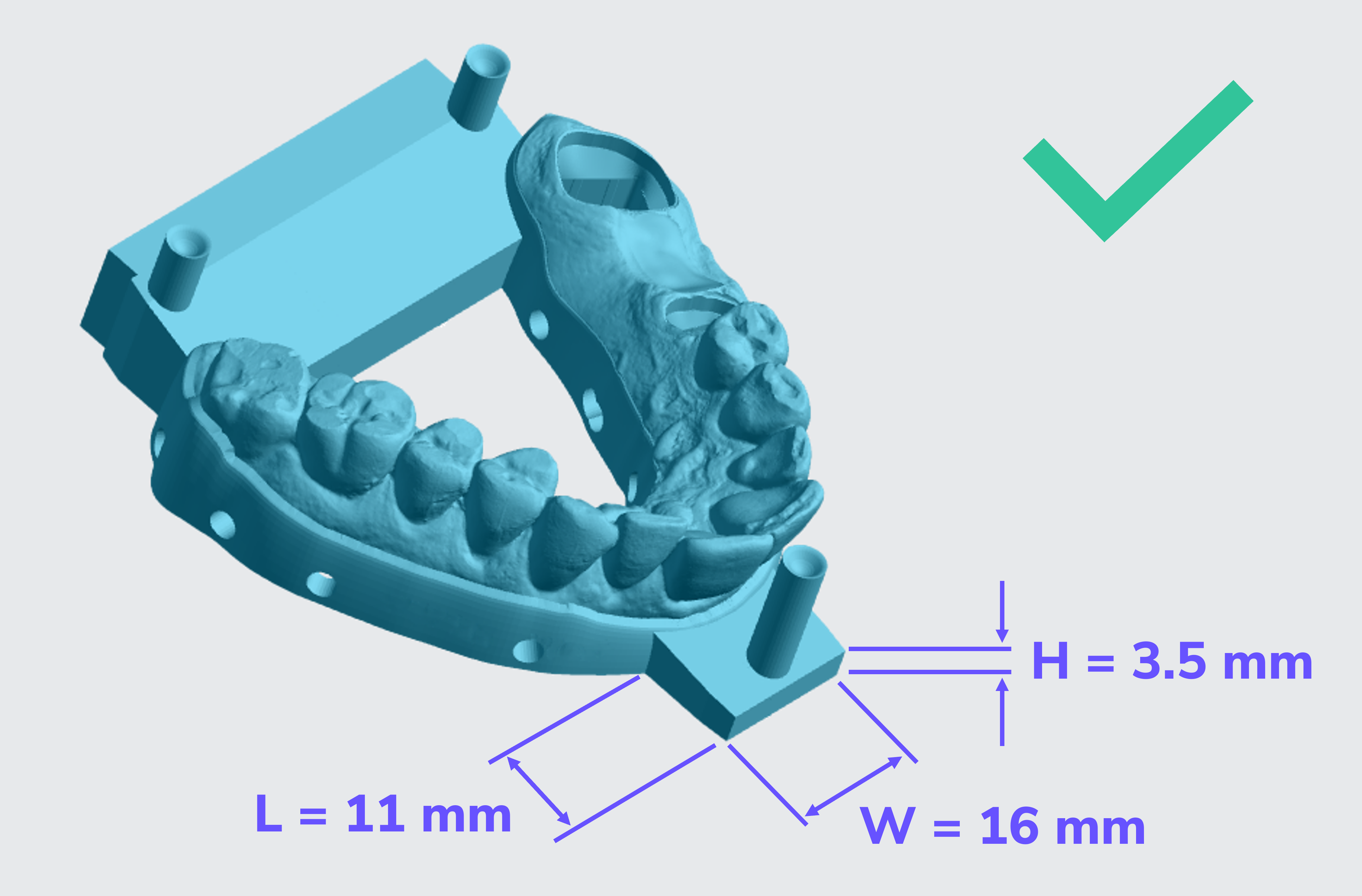 Good example of articulator base dimensions