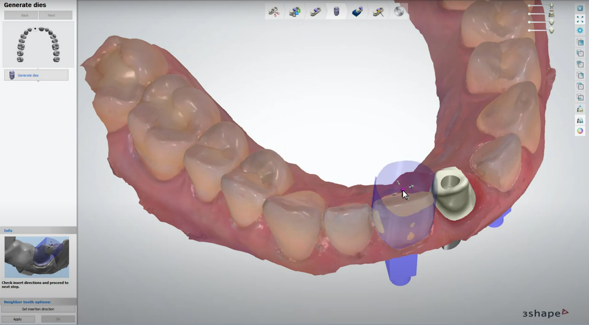 Image of 3shape CAD software Image of 3shape CAD software