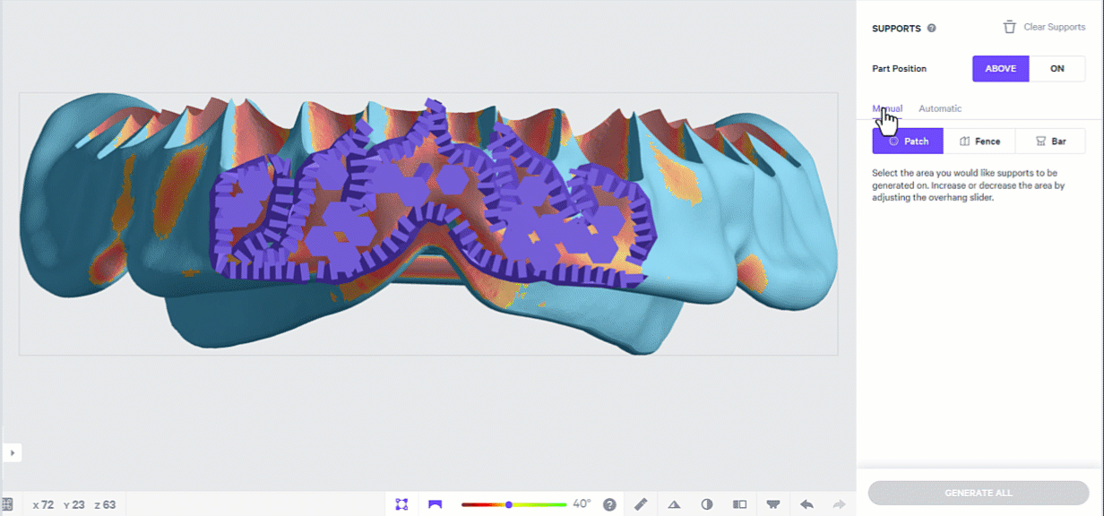 Supporting inner edge of lower denture Supporting inner edge of lower denture