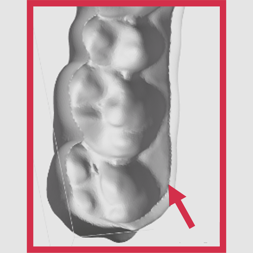 Supports will not connect to a sharp knife edge Supports will not connect to a sharp knife edge