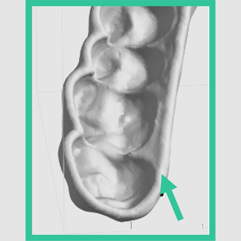 Supports connect well to a round edge. Supports connect well to a round edge.