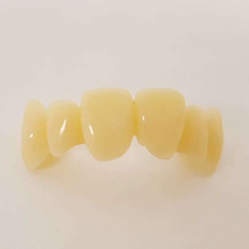 Dentca Cb Anterior Bridge Finished Polished.jpg
