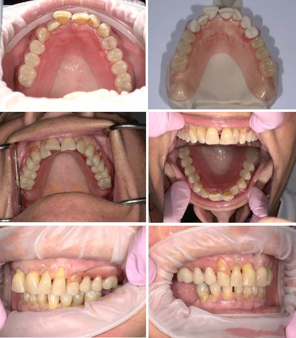 6 views of client's open mouth